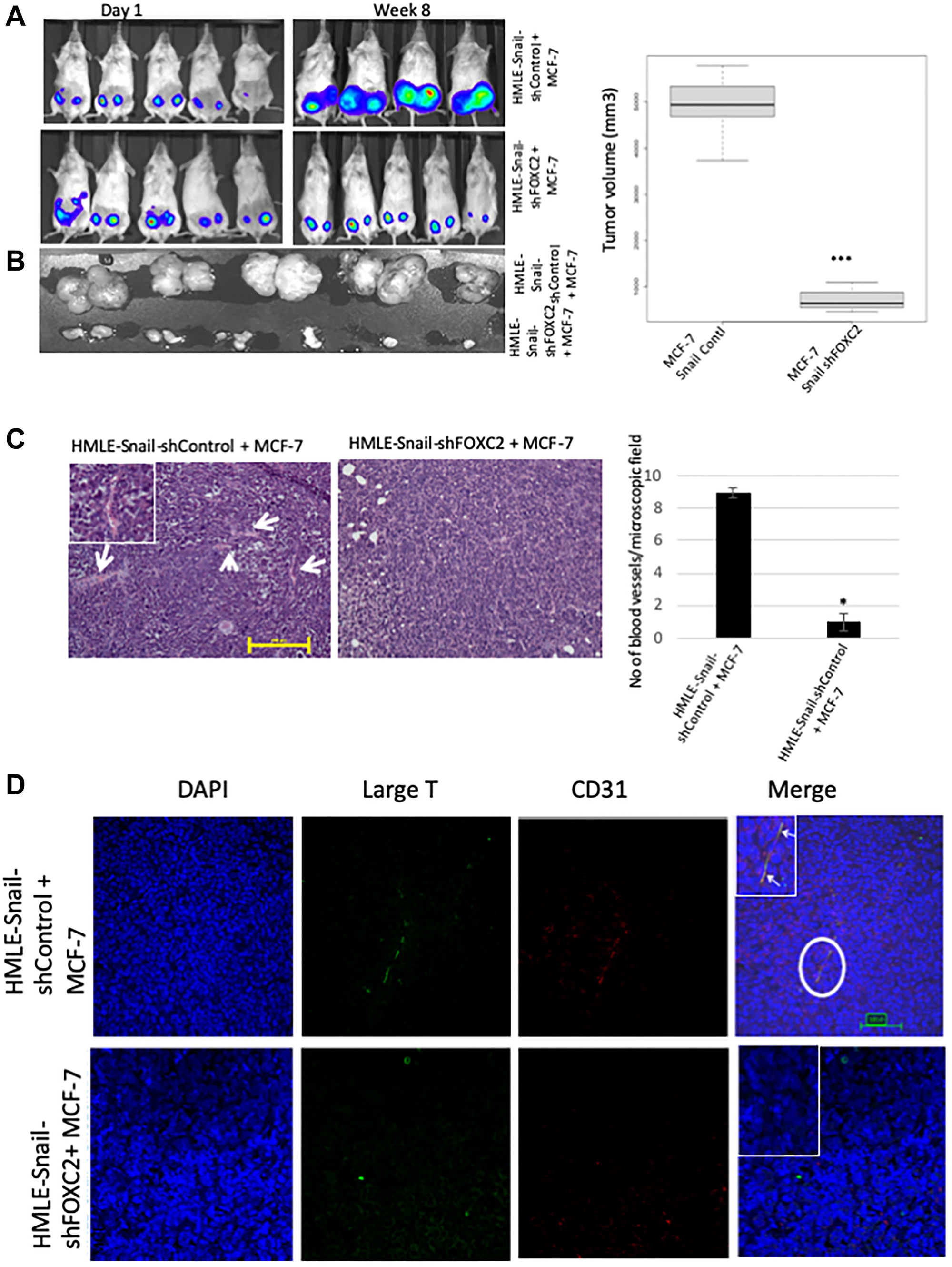 Figure 7: FOXC2 is necessary for the ability of cells that have undergone EMT to augment neoangiogenesis.